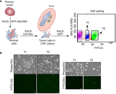 Phenotypic heterogeneity drives differential disease outcome in a mouse model of triple negative breast cancer